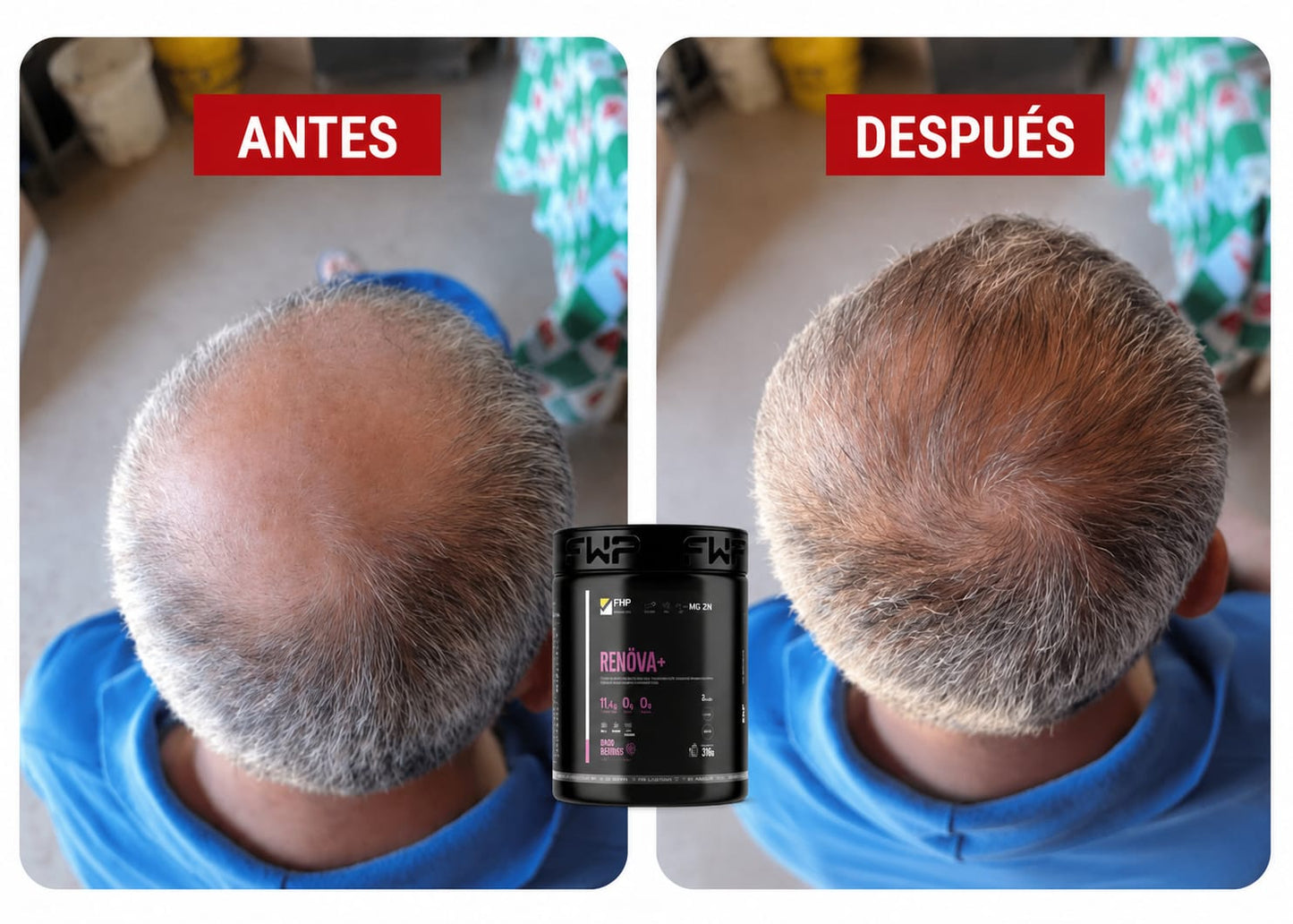 COLÁGENO RENOVA+ CON BIOPÉPTIDOS ACTIVOS