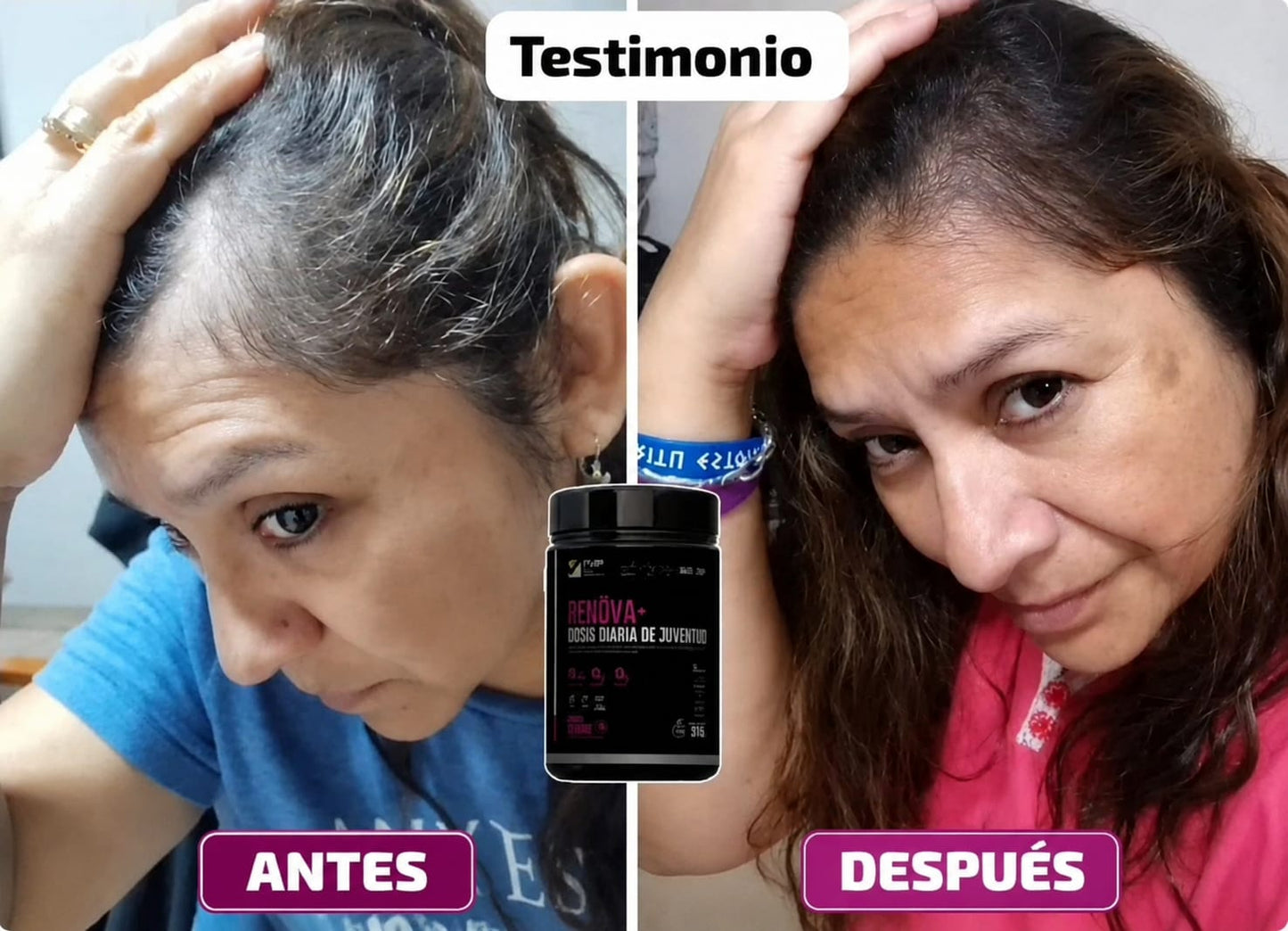 COLÁGENO RENOVA+ CON BIOPÉPTIDOS ACTIVOS